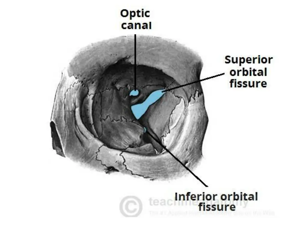 slide8