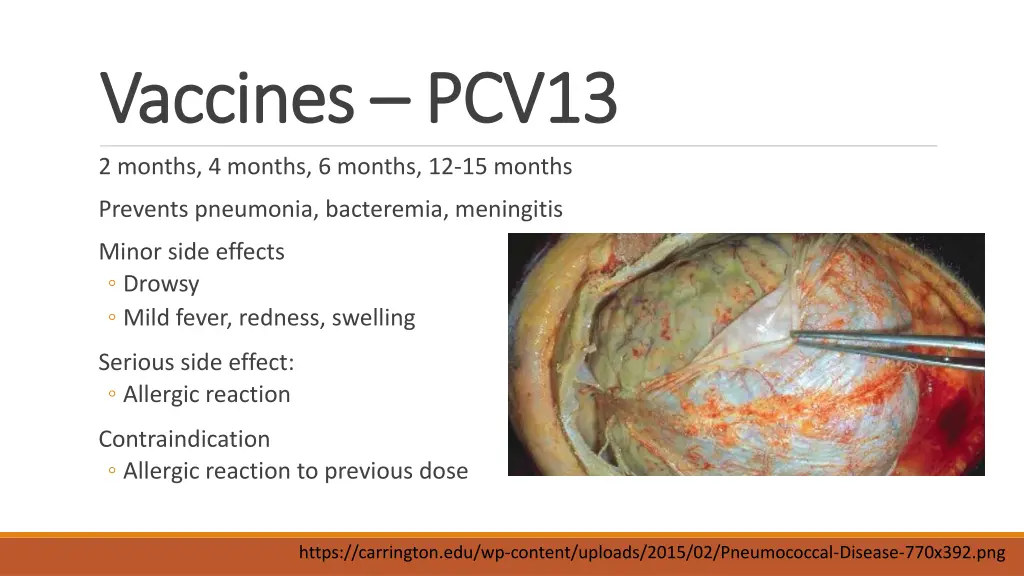 vaccines vaccines pcv13