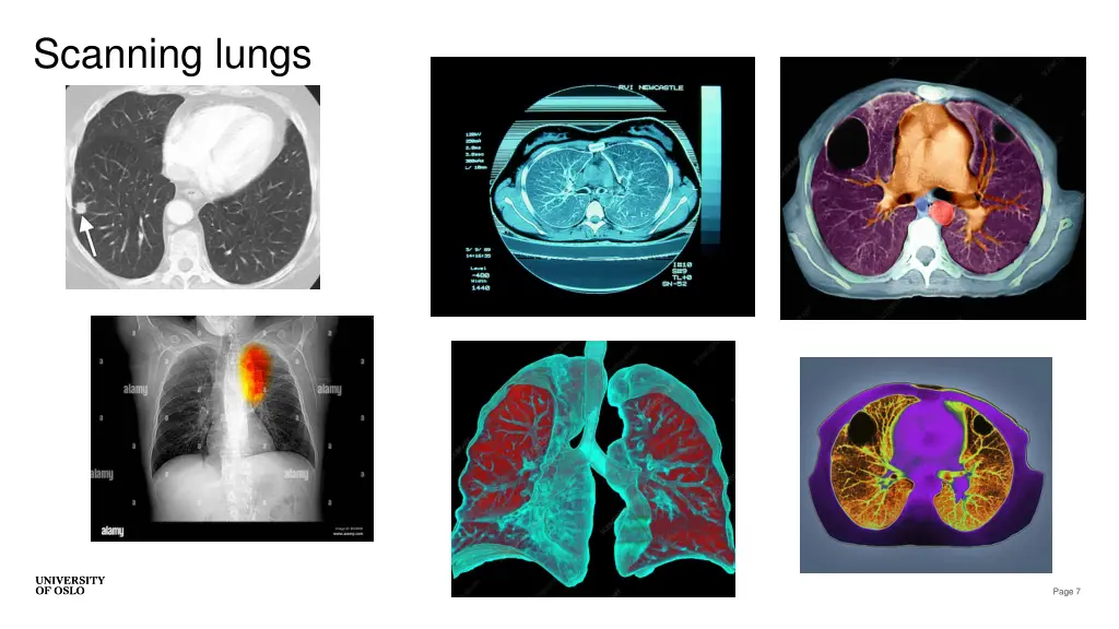 scanning lungs