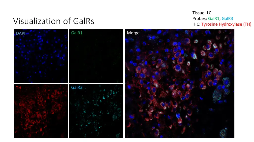 tissue lc probes galr1 galr3 ihc tyrosine