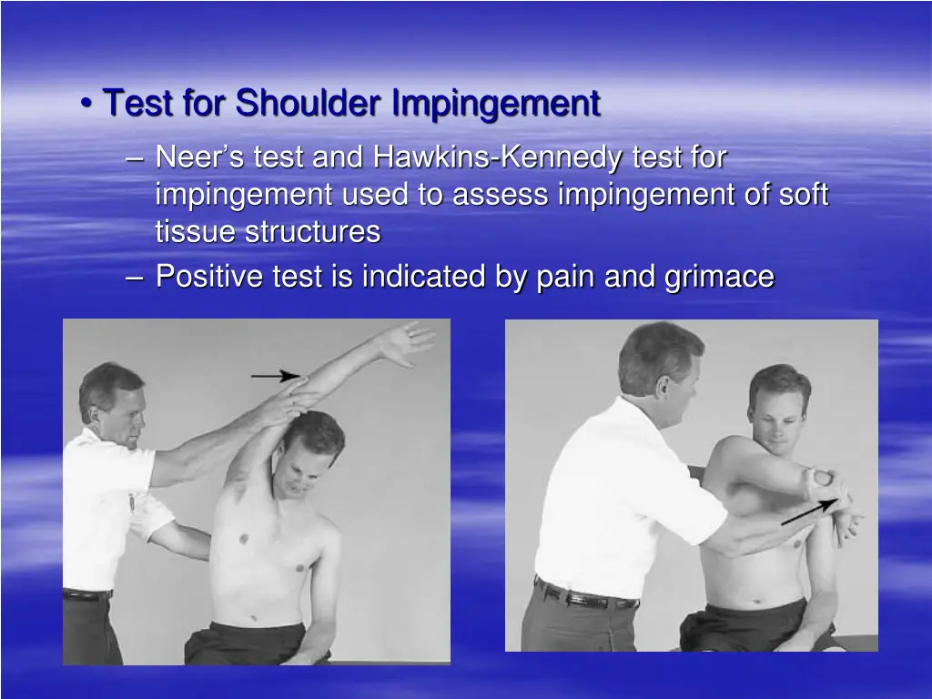 test for shoulder impingement neer s test