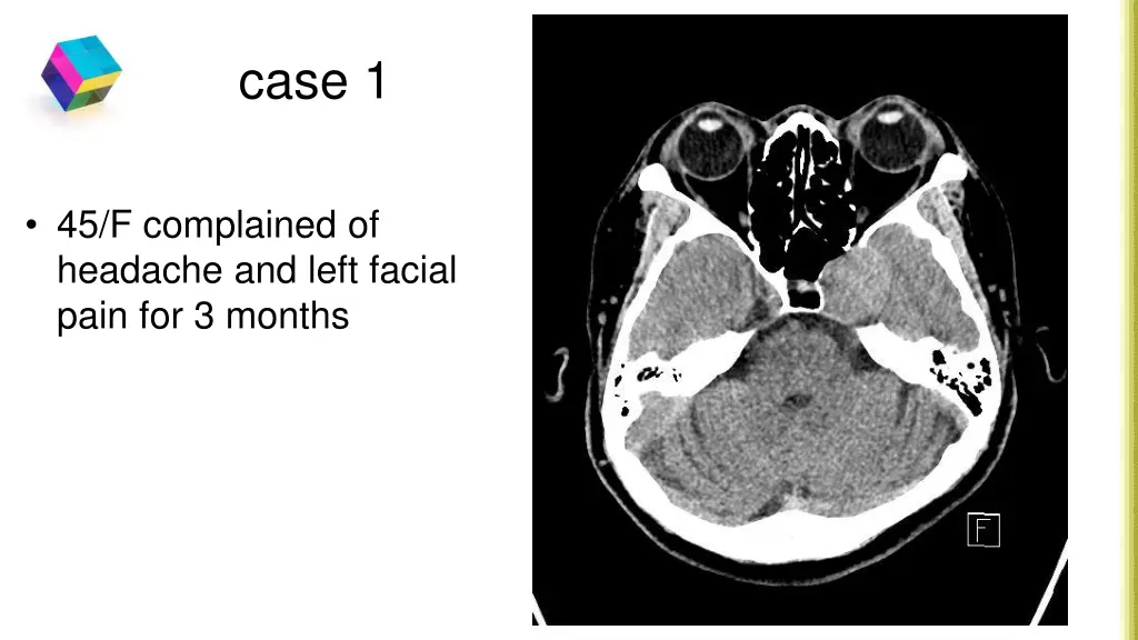 case 1