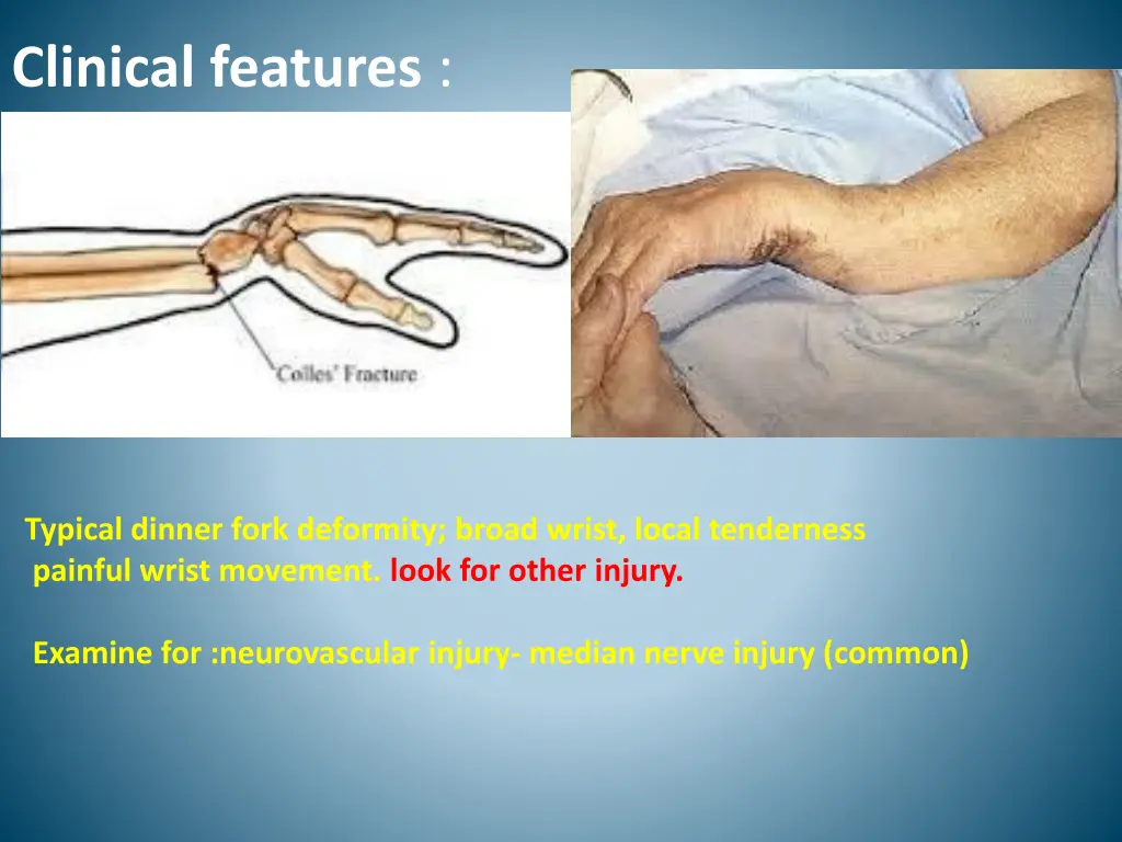 clinical features