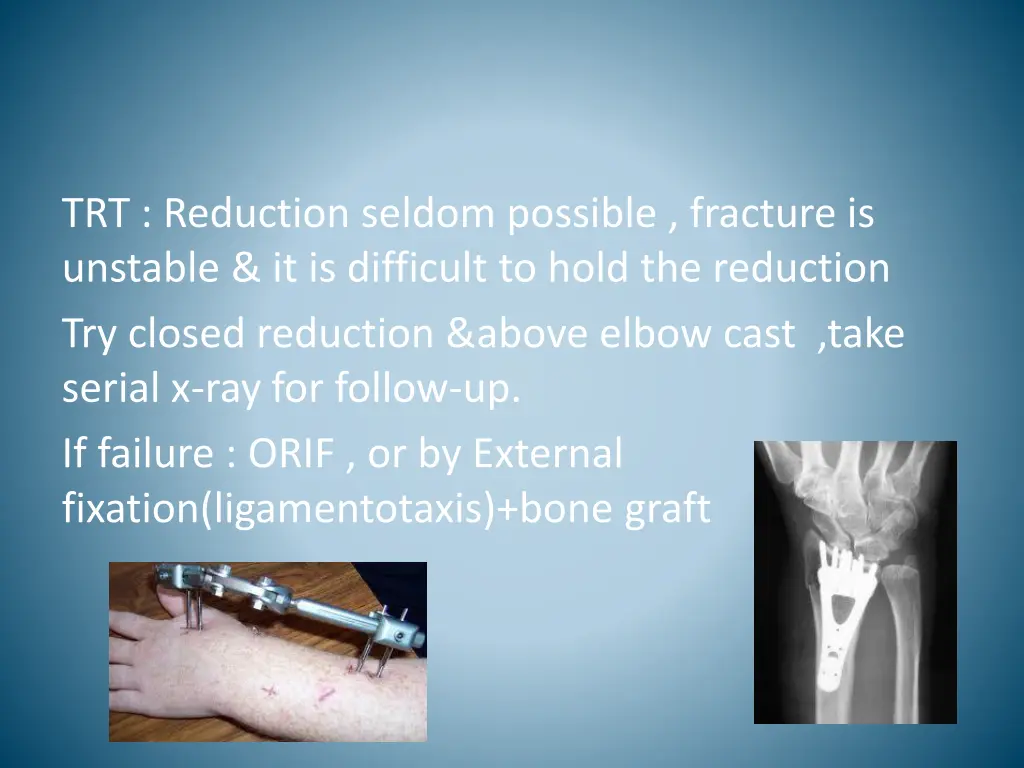 trt reduction seldom possible fracture