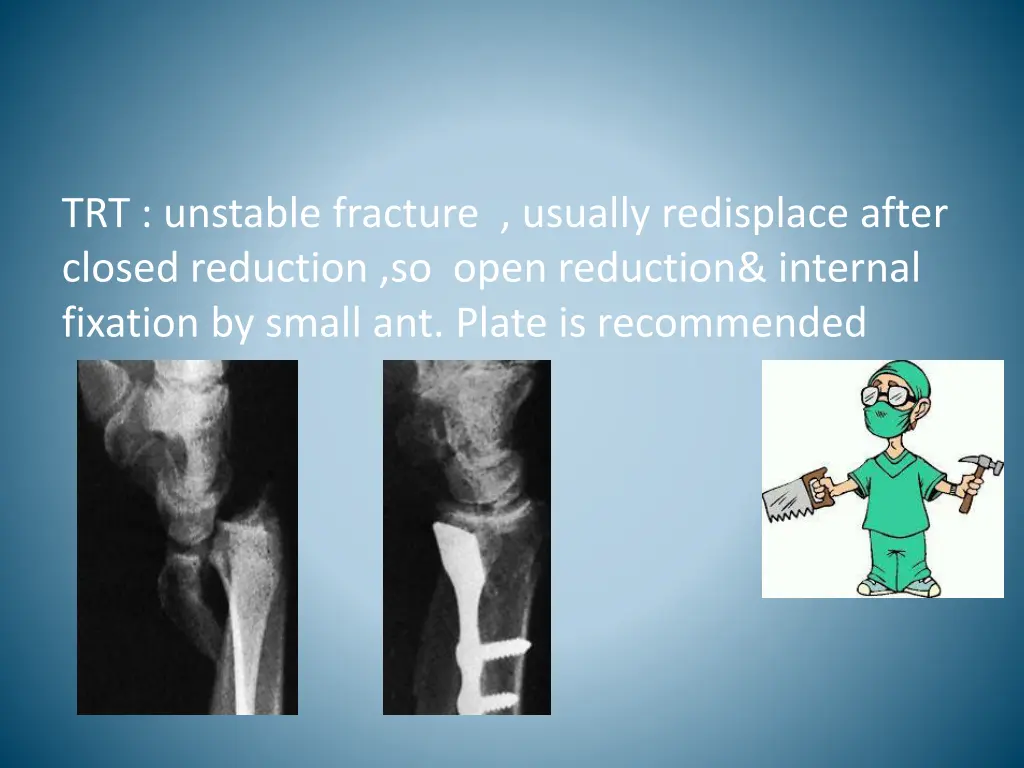 trt unstable fracture usually redisplace after