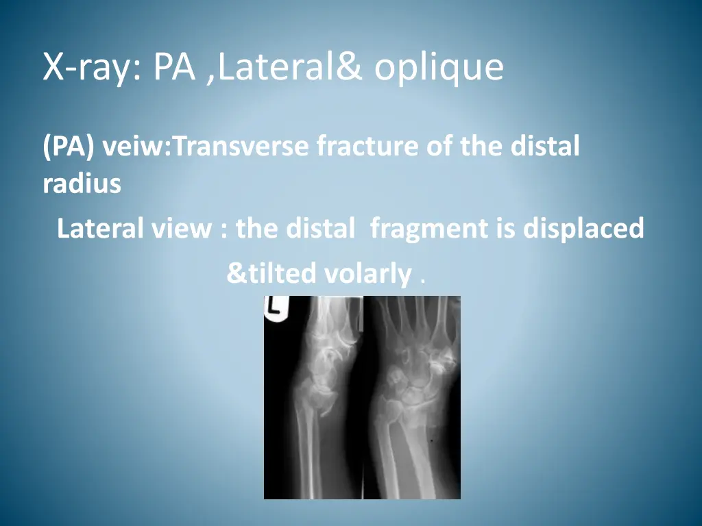 x ray pa lateral oplique