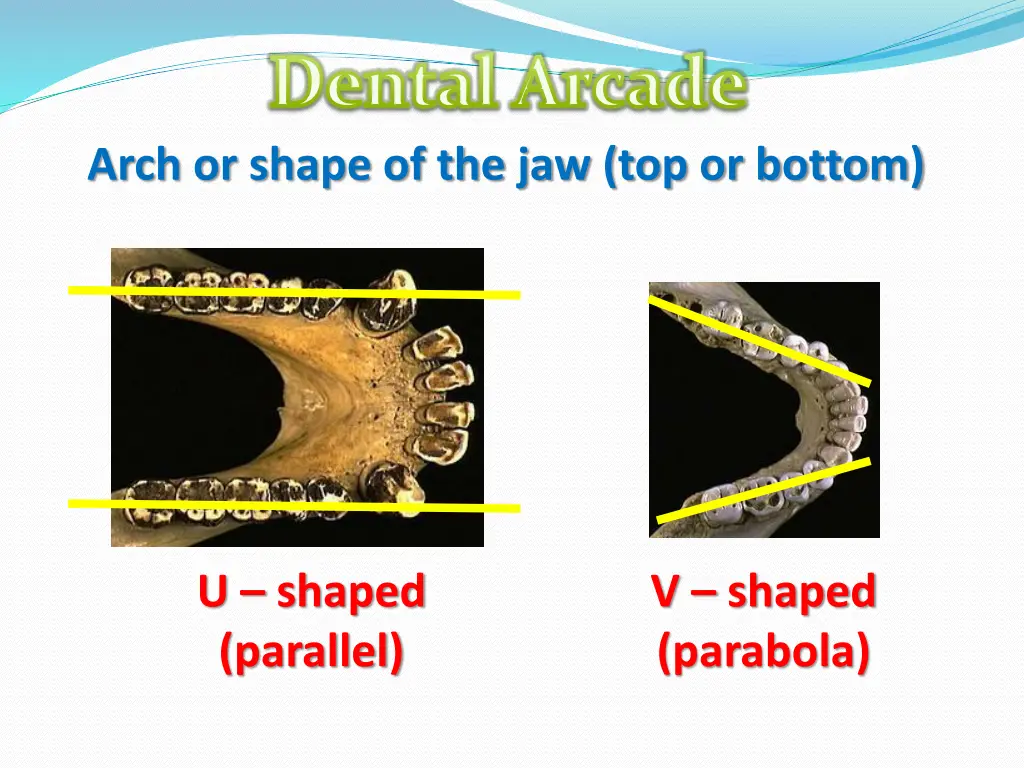 dental arcade arch or shape