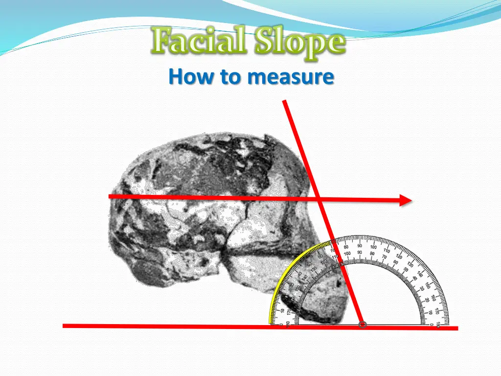 facial slope how to measure 1