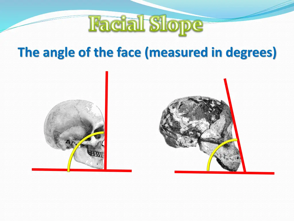 facial slope