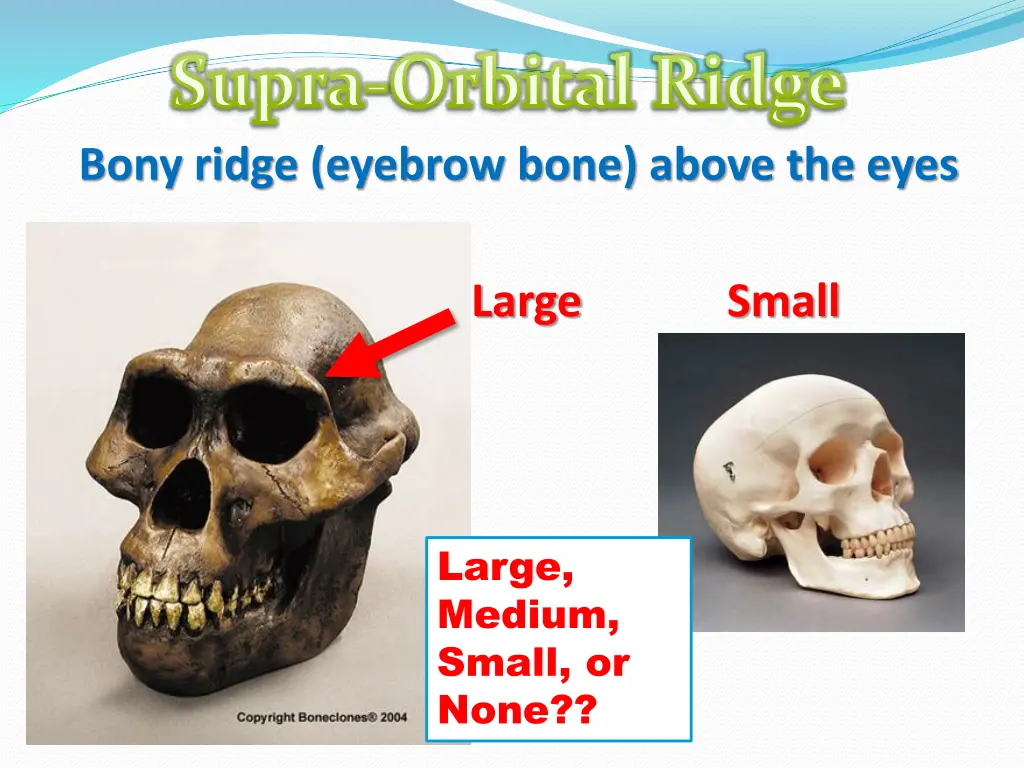 supra orbital ridge bony ridge eyebrow bone above