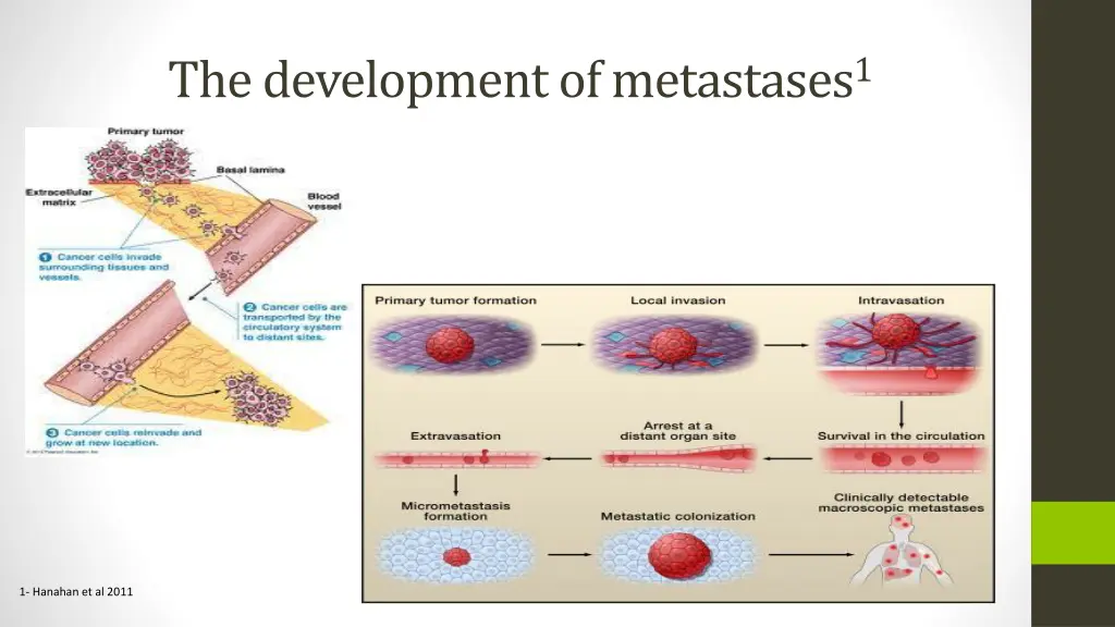 the development of metastases 1