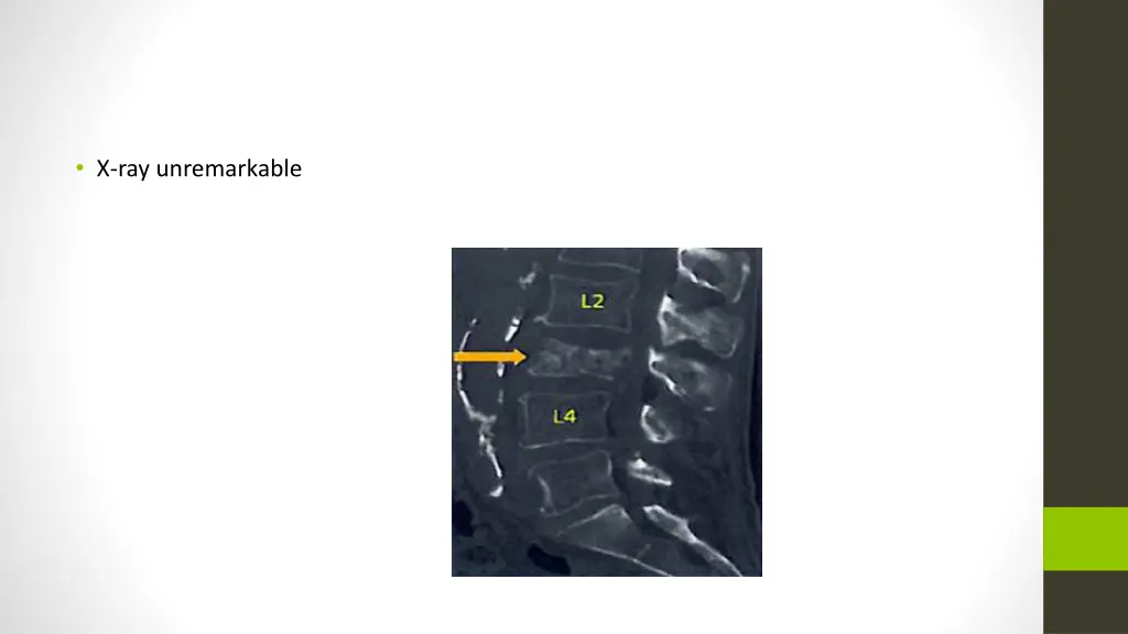 x ray unremarkable