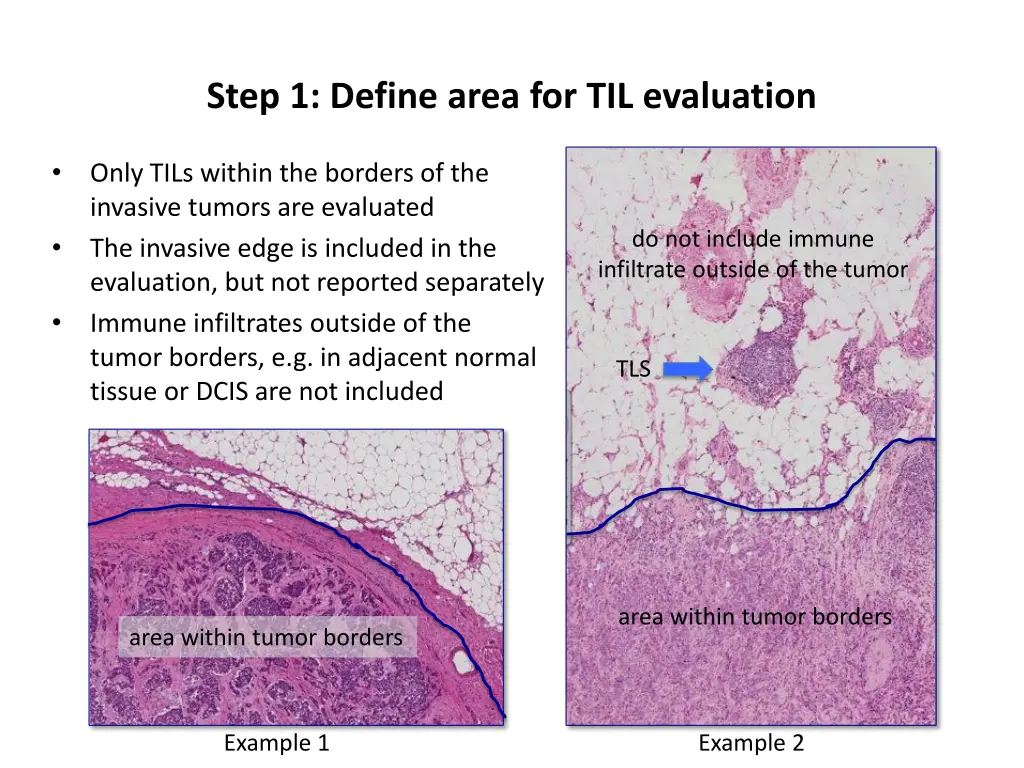 step 1 define area for til evaluation