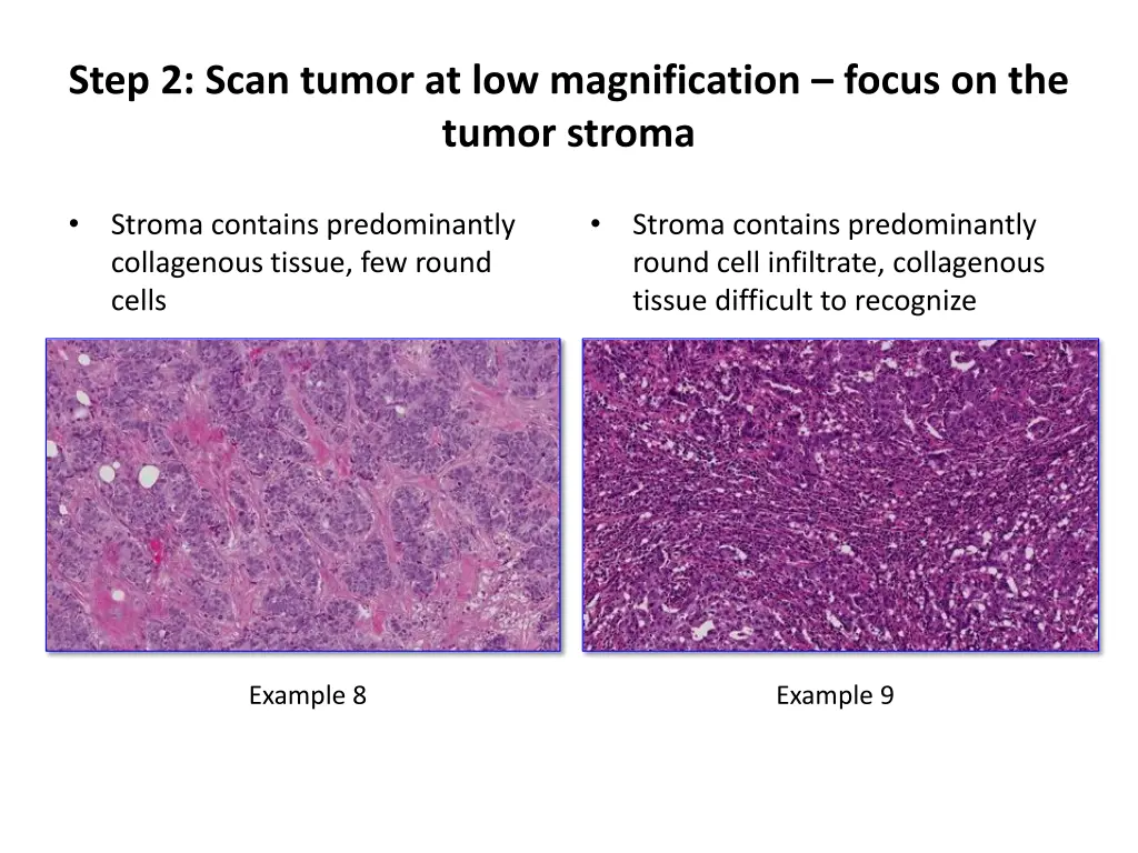 step 2 scan tumor at low magnification focus 1