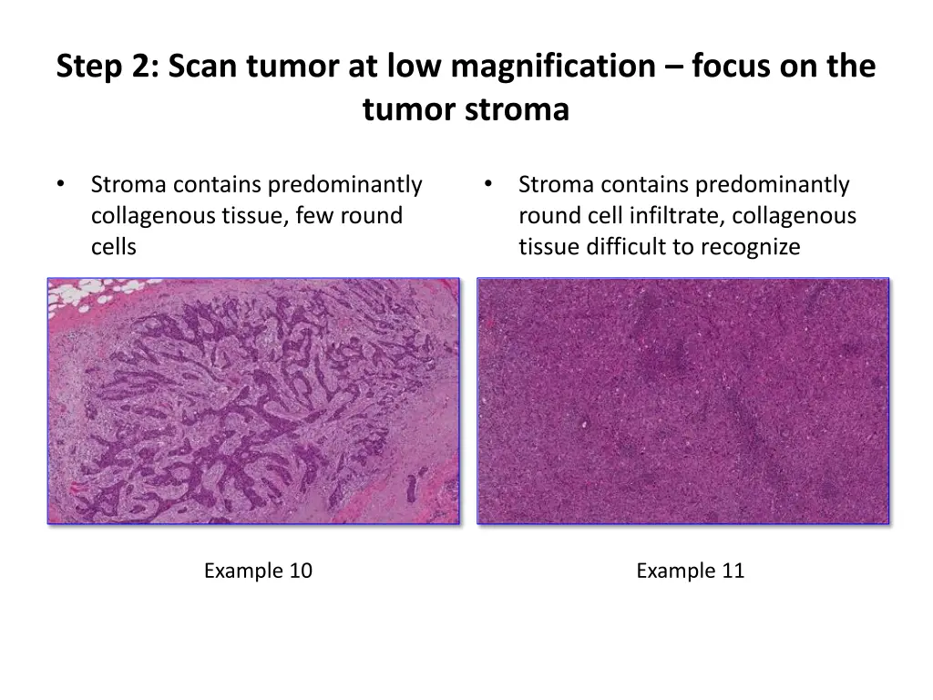 step 2 scan tumor at low magnification focus 2