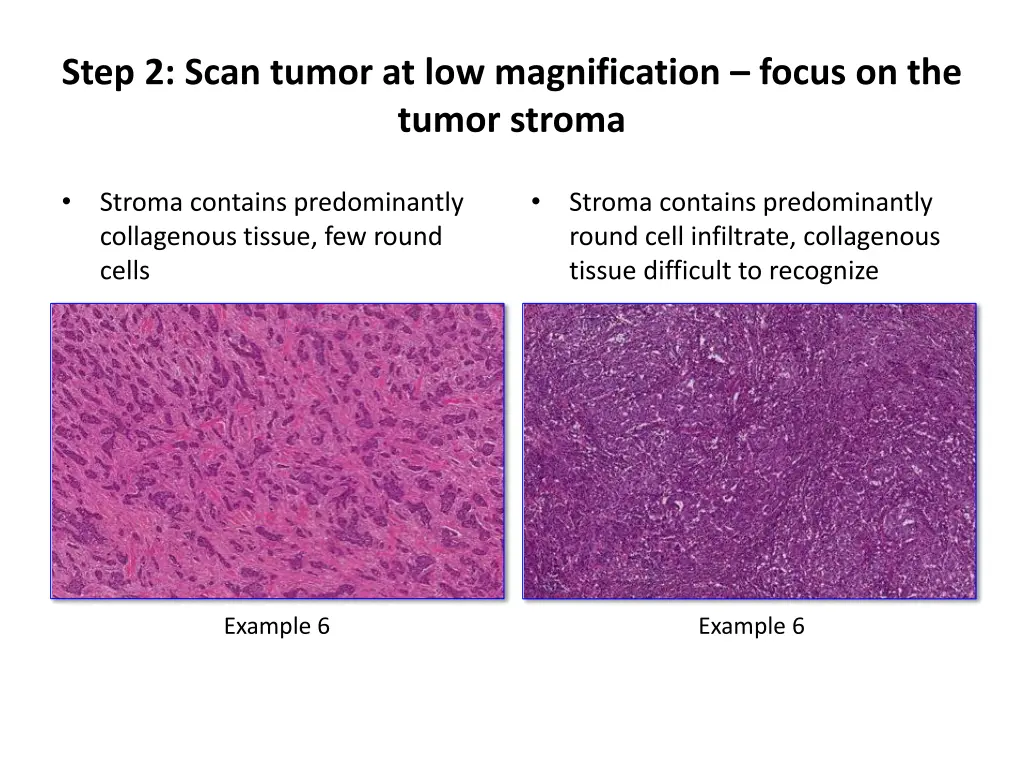 step 2 scan tumor at low magnification focus