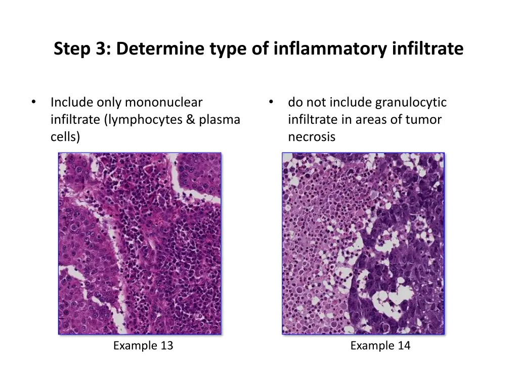 step 3 determine type of inflammatory infiltrate 1