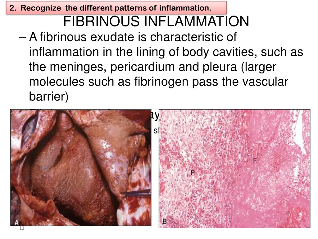 2 recognize the different patterns of inflammation 3