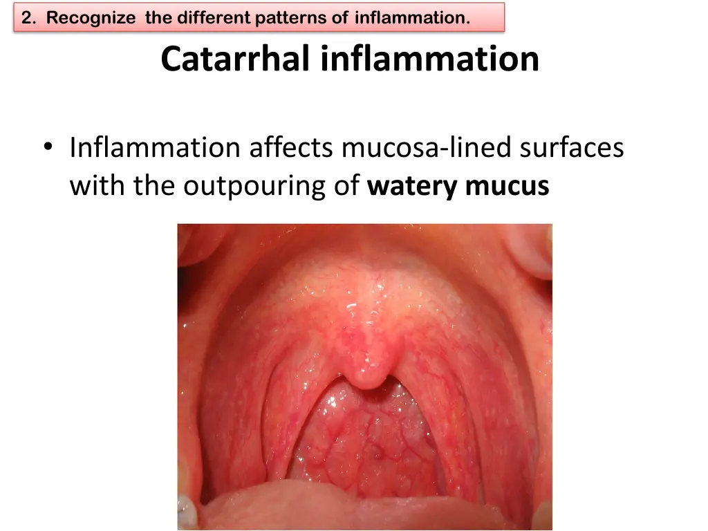 2 recognize the different patterns of inflammation 4