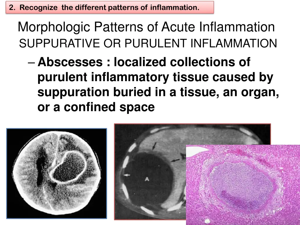 2 recognize the different patterns of inflammation 7