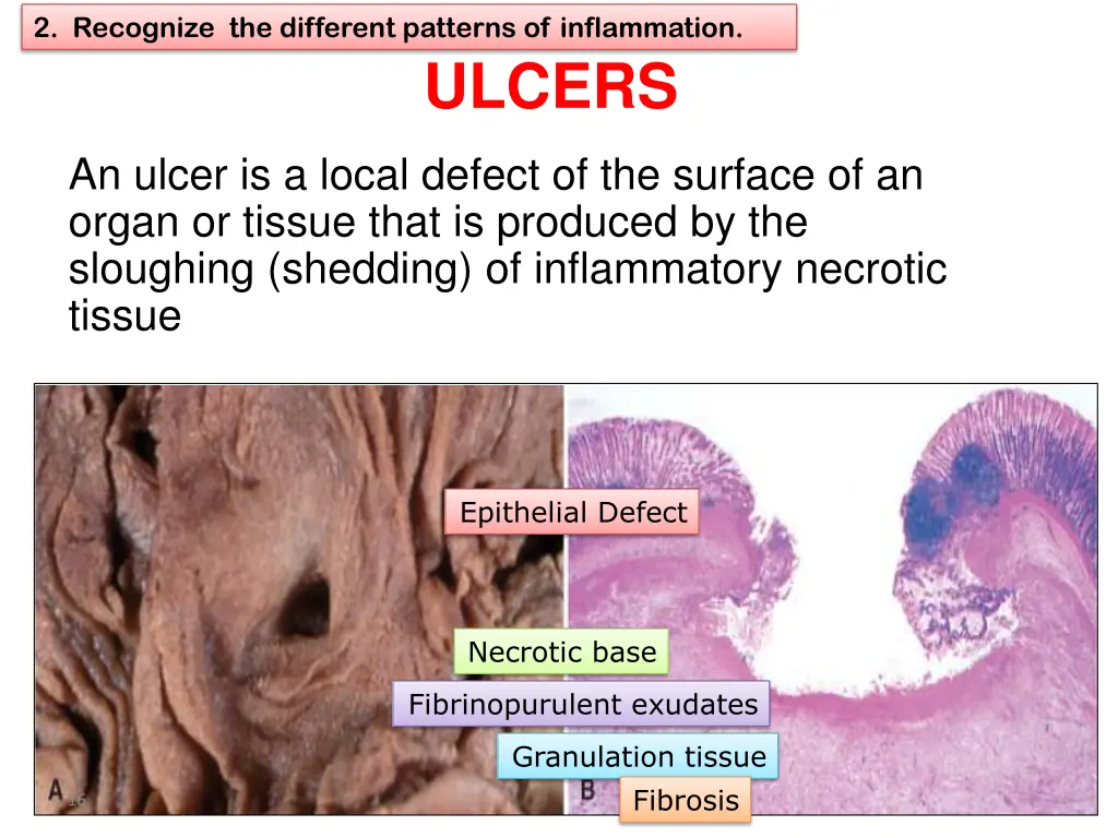 2 recognize the different patterns of inflammation 8