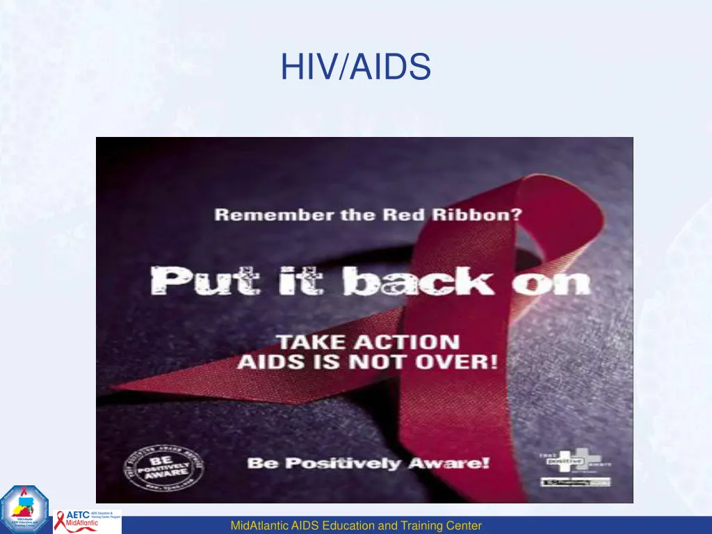 hiv aids