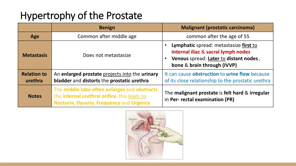 hypertrophy of the prostate hypertrophy