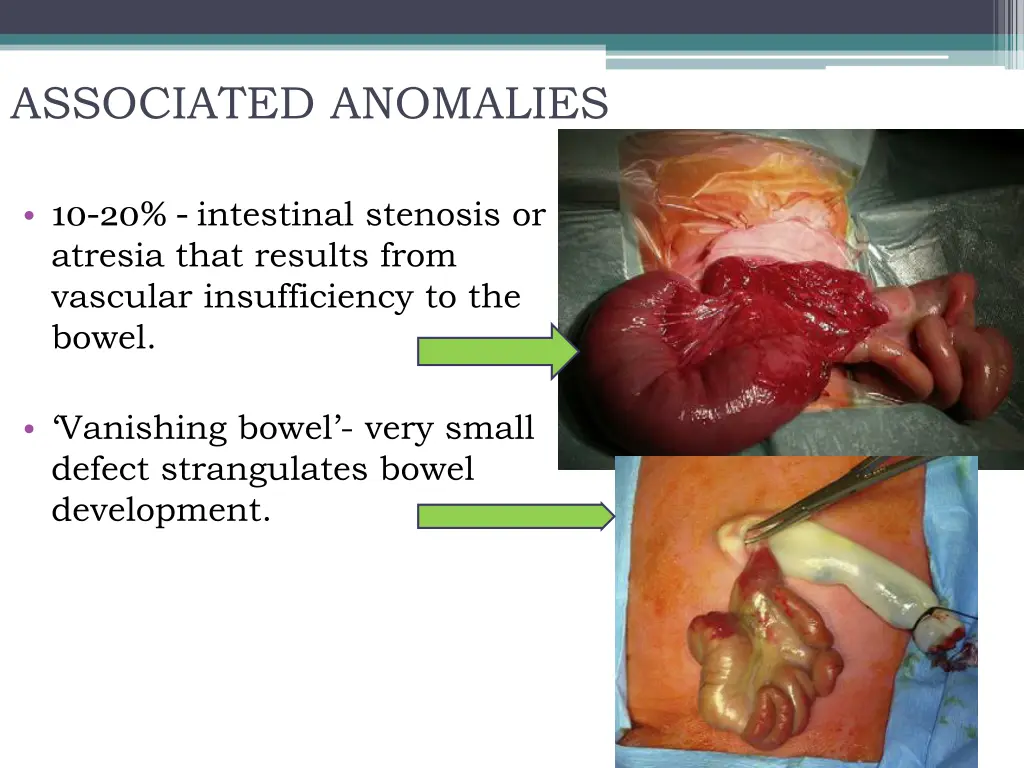 associated anomalies