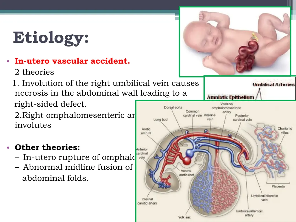 etiology