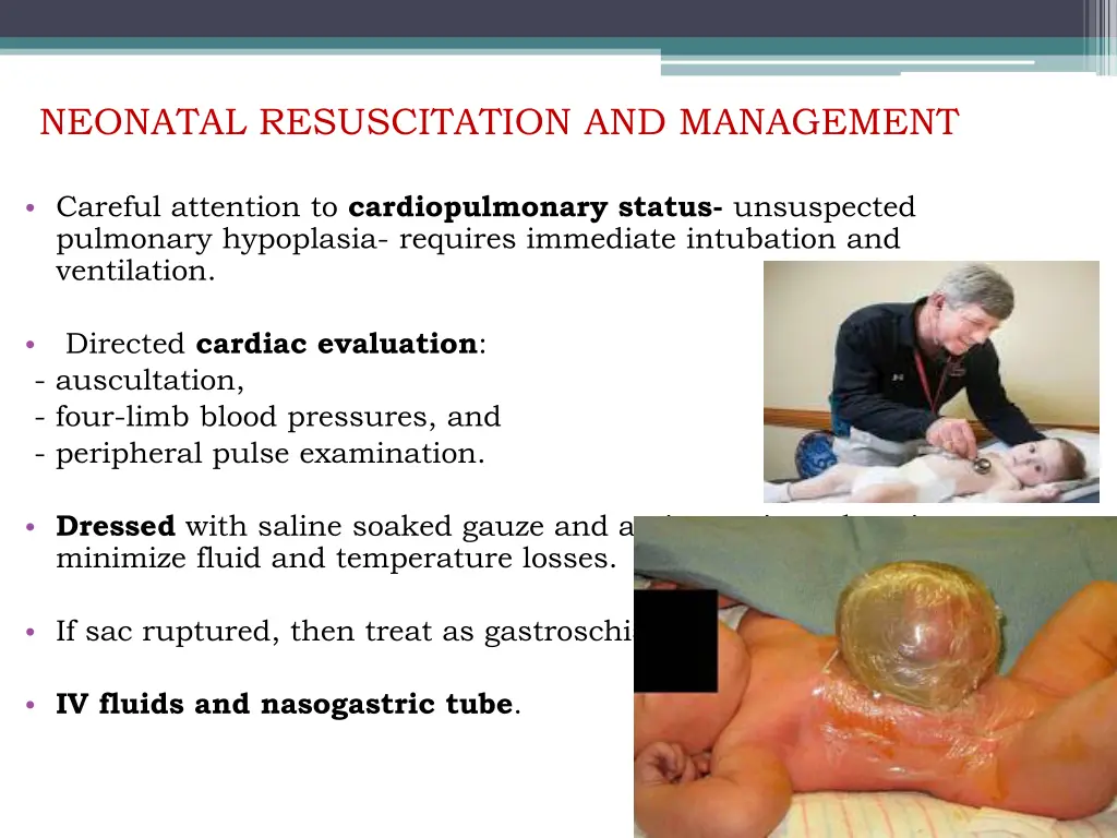 neonatal resuscitation and management 1