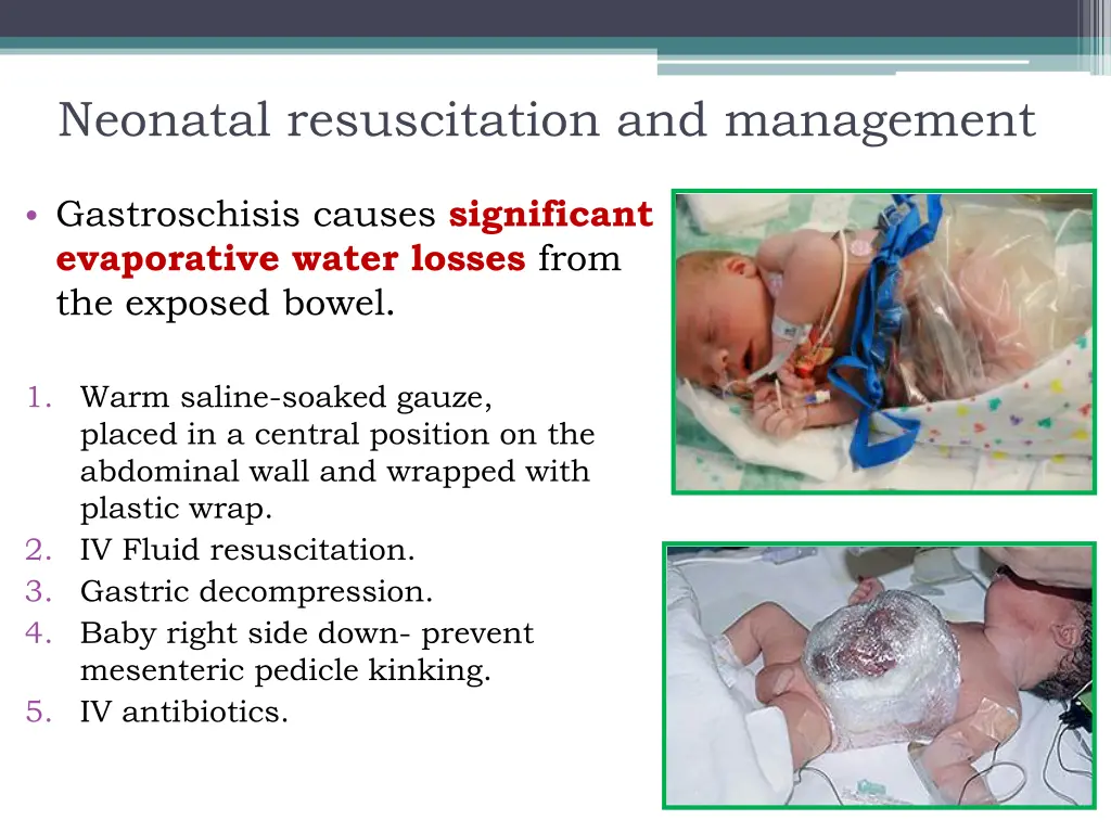 neonatal resuscitation and management