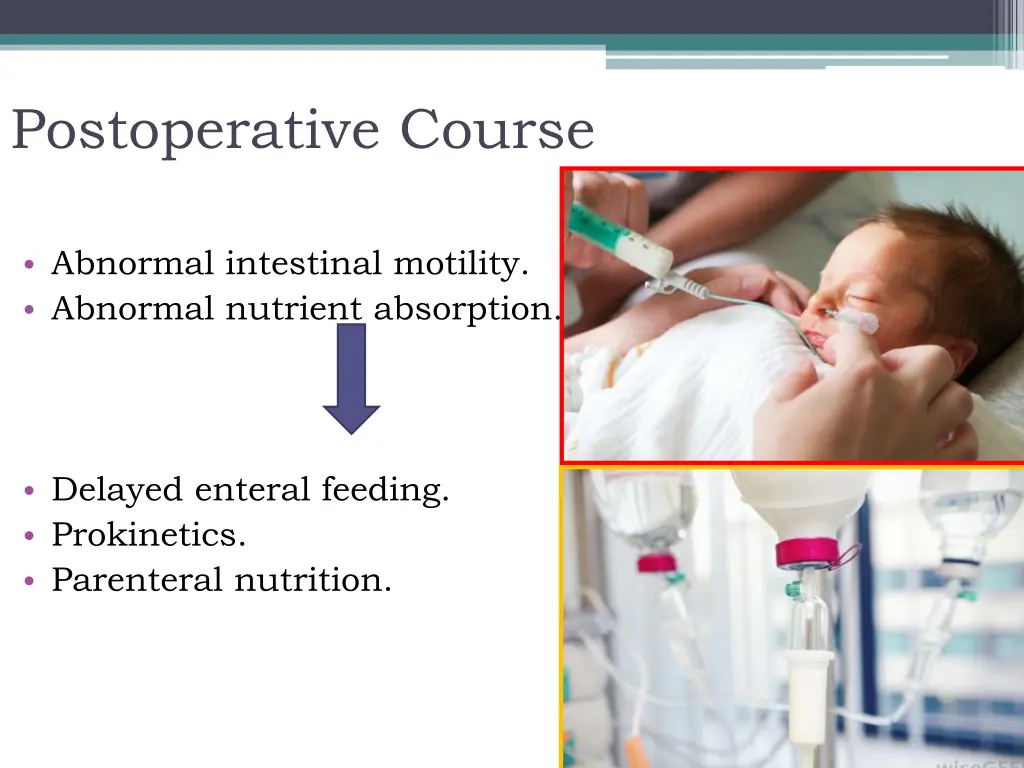 postoperative course