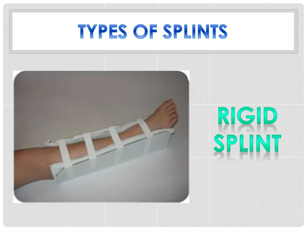 types of splints 2