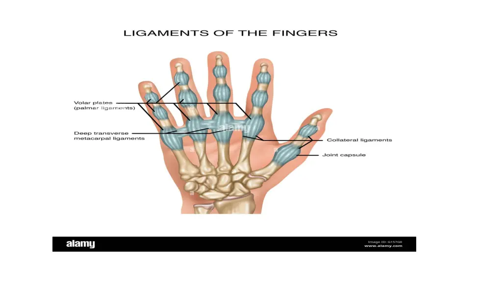 slide3