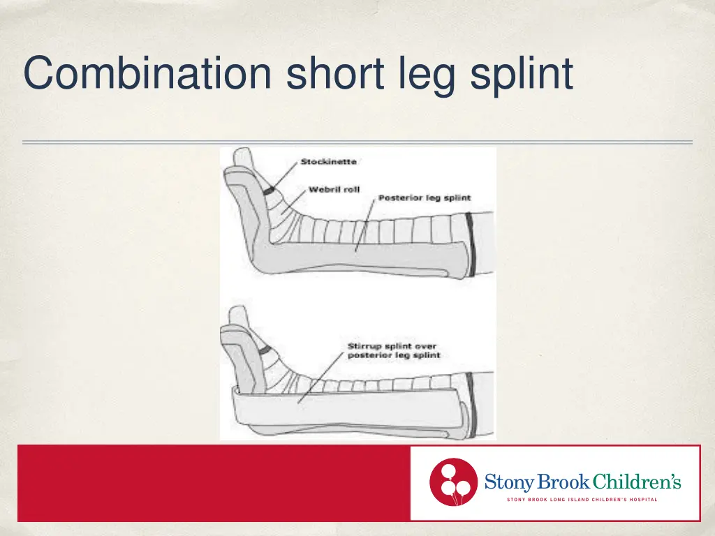 combination short leg splint