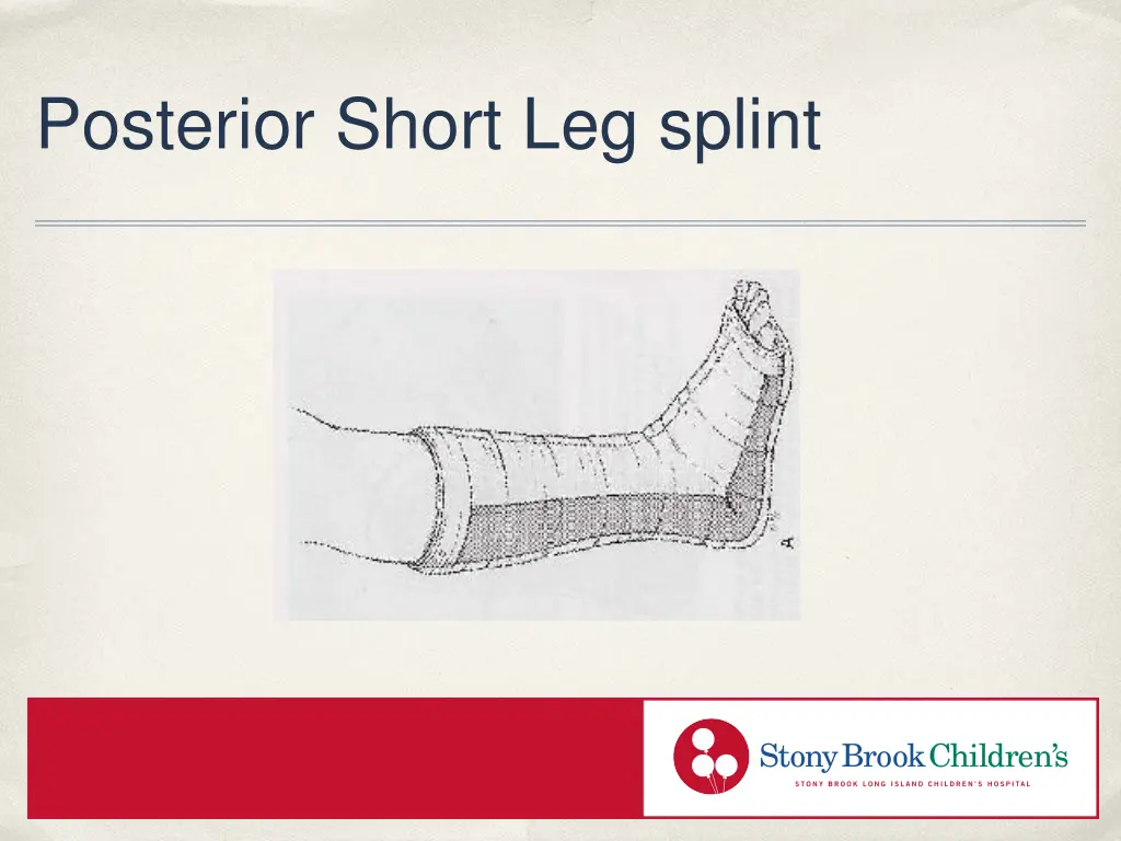 posterior short leg splint