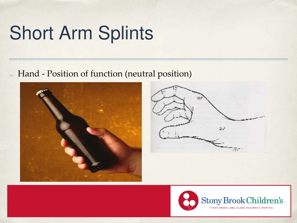 short arm splints