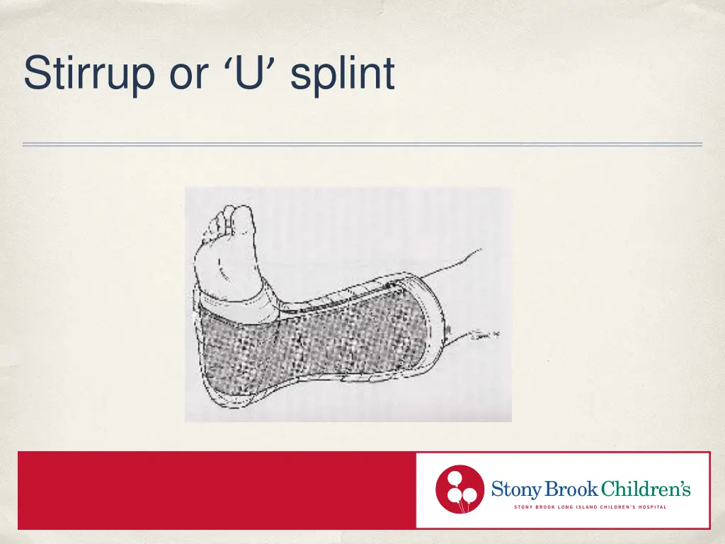 stirrup or u splint