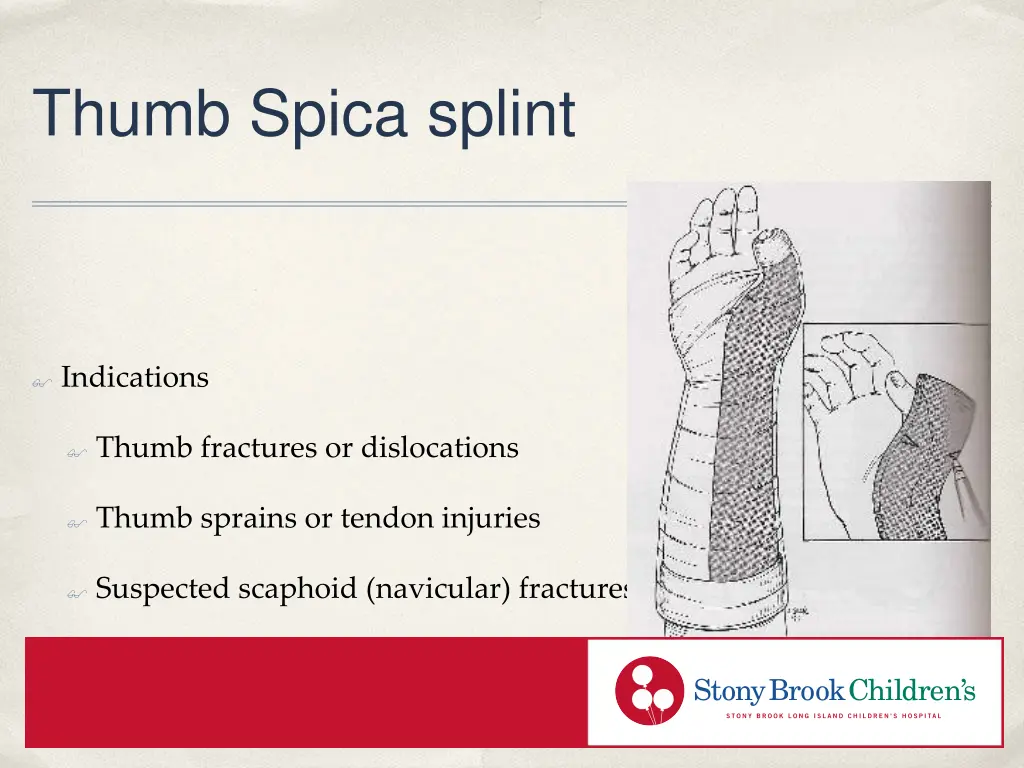 thumb spica splint