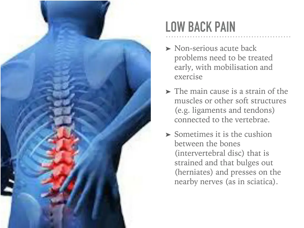 low back pain