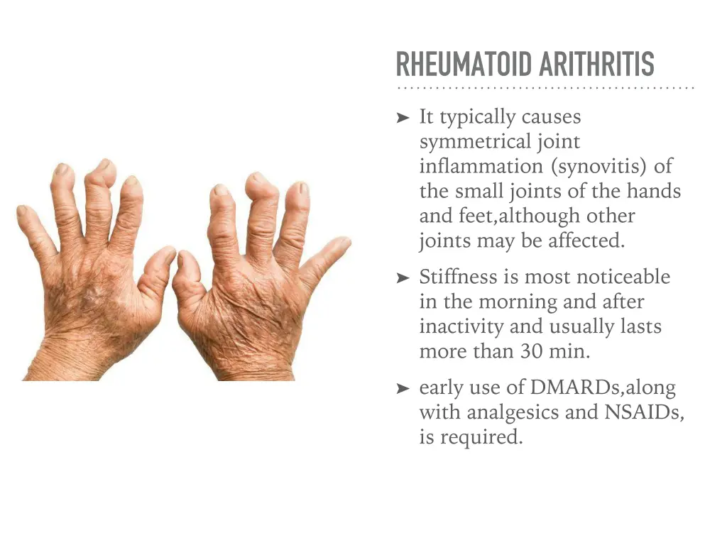 rheumatoid arithritis