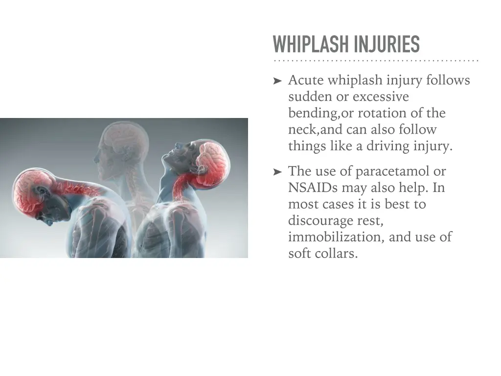 whiplash injuries