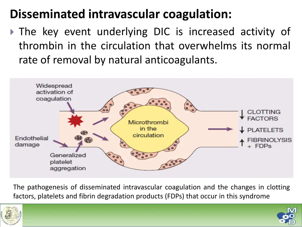 disseminated intravascular coagulation