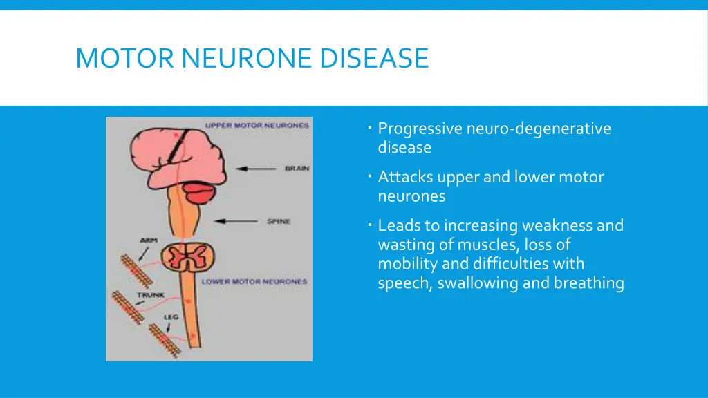 motor neurone disease