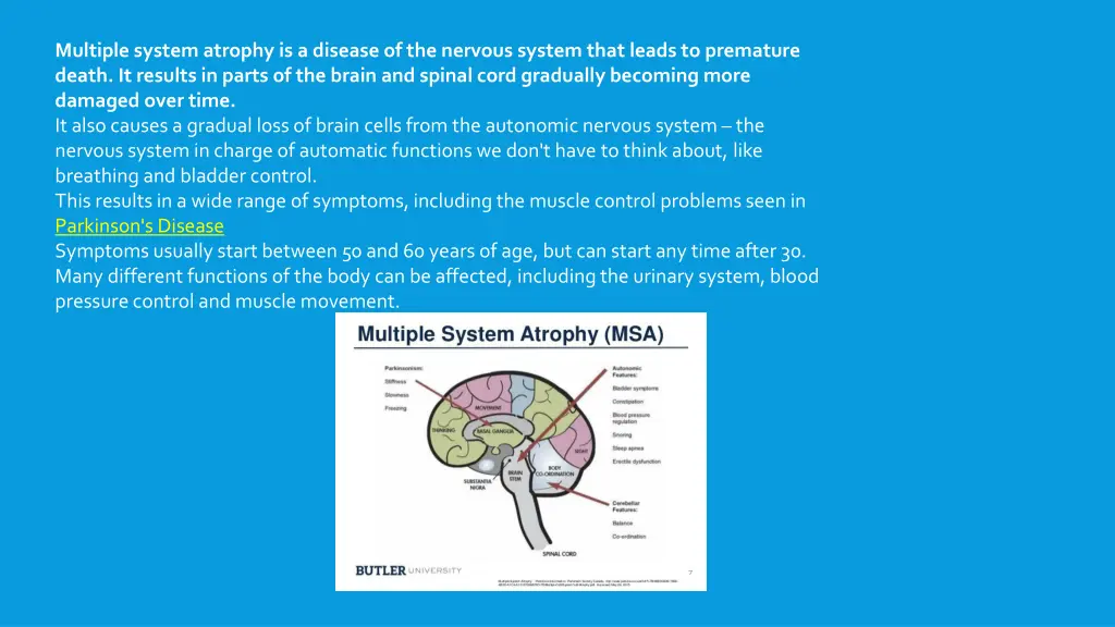 multiple system atrophy is a disease