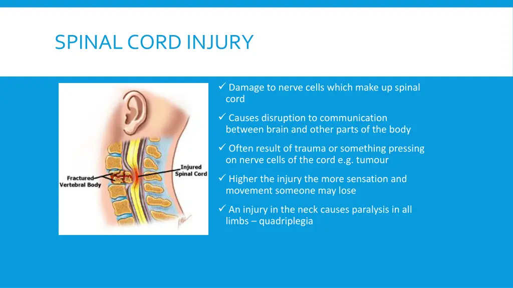 spinal cord injury