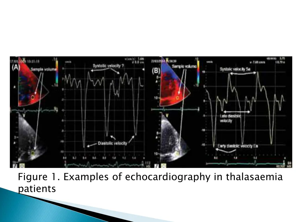 figure 1 examples of echocardiography