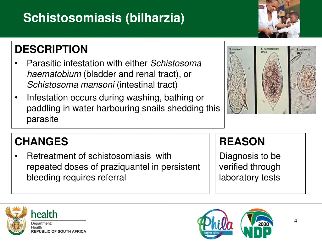 schistosomiasis bilharzia