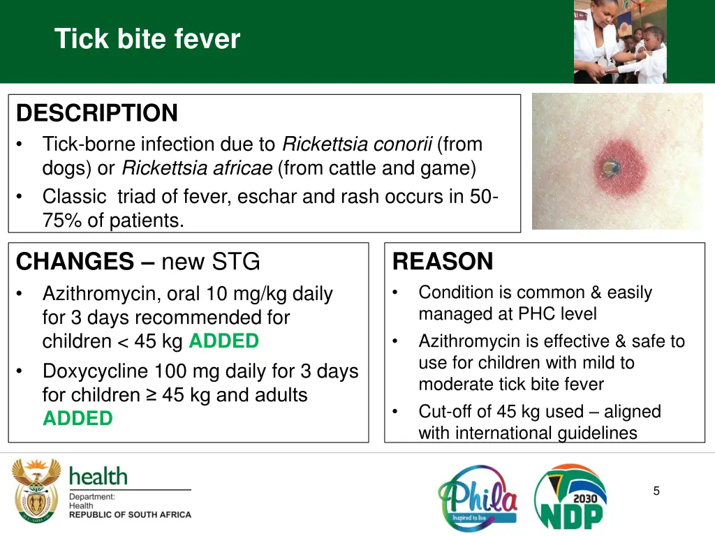 tick bite fever