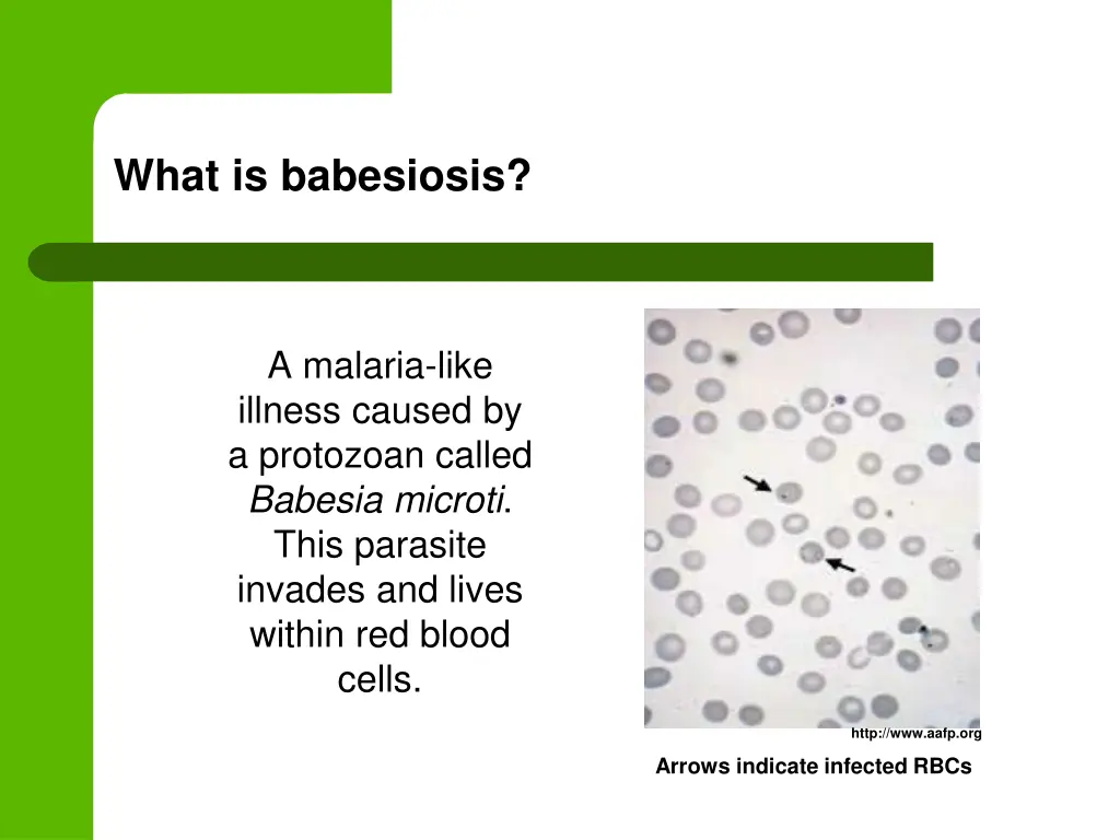 what is babesiosis